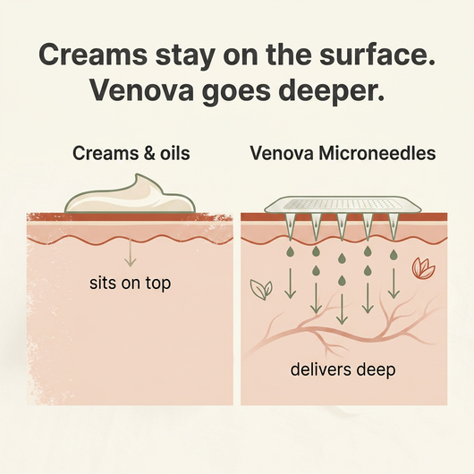 Varicose Vein Treatment Patch