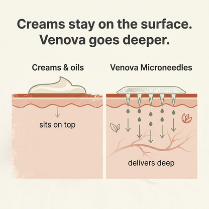 Varicose Vein Treatment Patch